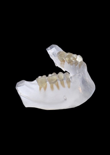 Resin UTR8100 for Dental Transparent Model